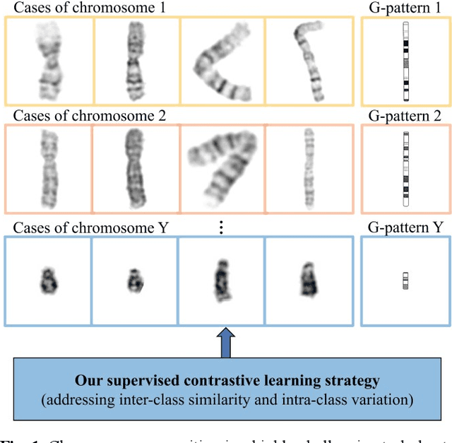 Figure 1 for Supervised Contrastive Learning for Fine-grained Chromosome Recognition