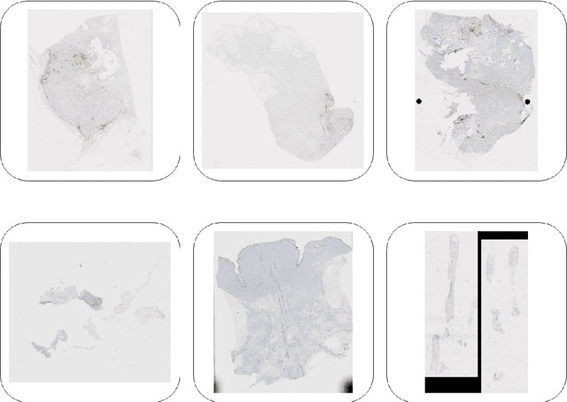 Figure 1 for PD-L1 Classification of Weakly-Labeled Whole Slide Images of Breast Cancer
