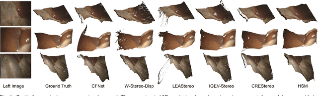 Figure 4 for Towards Safer Robot-Assisted Surgery: A Markerless Augmented Reality Framework