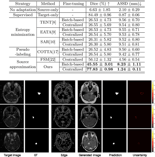 Figure 2 for Reliable Source Approximation: Source-Free Unsupervised Domain Adaptation for Vestibular Schwannoma MRI Segmentation