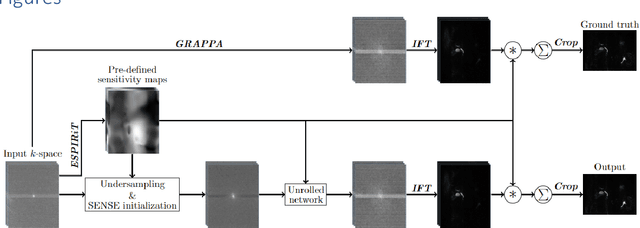 Figure 1 for Accelerated MR Cholangiopancreatography with Deep Learning-based Reconstruction