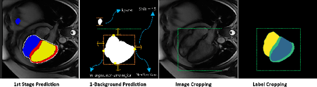 Figure 3 for Crop and Couple: cardiac image segmentation using interlinked specialist networks