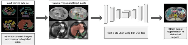 Figure 1 for Towards Automatic Abdominal MRI Organ Segmentation: Leveraging Synthesized Data Generated From CT Labels