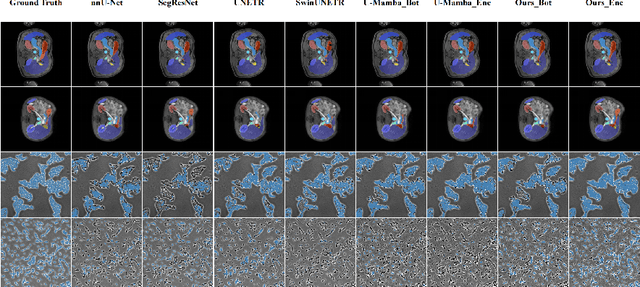 Figure 3 for xLSTM-UNet can be an Effective 2D & 3D Medical Image Segmentation Backbone with Vision-LSTM (ViL) better than its Mamba Counterpart