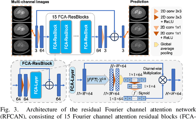 Figure 3 for Deep Few-view High-resolution Photon-counting Extremity CT at Halved Dose for a Clinical Trial