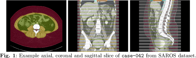 Figure 1 for Enhanced Muscle and Fat Segmentation for CT-Based Body Composition Analysis: A Comparative Study