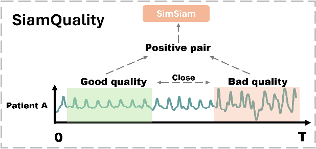 Figure 1 for SiamQuality: A ConvNet-Based Foundation Model for Imperfect Physiological Signals