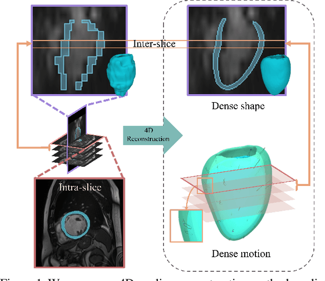 Figure 1 for 4D Myocardium Reconstruction with Decoupled Motion and Shape Model