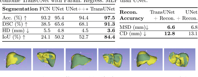 Figure 2 for LiverUSRecon: Automatic 3D Reconstruction and Volumetry of the Liver with a Few Partial Ultrasound Scans