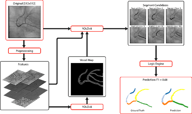 Figure 1 for YOLO-Angio: An Algorithm for Coronary Anatomy Segmentation