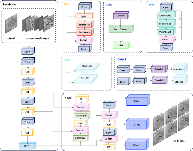 Figure 3 for YOLO-Angio: An Algorithm for Coronary Anatomy Segmentation