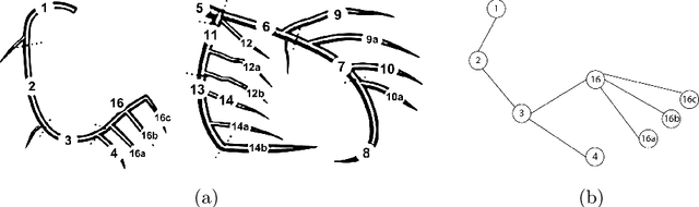 Figure 4 for YOLO-Angio: An Algorithm for Coronary Anatomy Segmentation