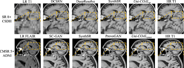 Figure 4 for Uni-COAL: A Unified Framework for Cross-Modality Synthesis and Super-Resolution of MR Images