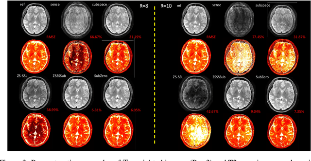 Figure 3 for SubZero: Subspace Zero-Shot MRI Reconstruction