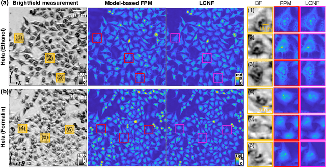 Figure 2 for Local Conditional Neural Fields for Versatile and Generalizable Large-Scale Reconstructions in Computational Imaging