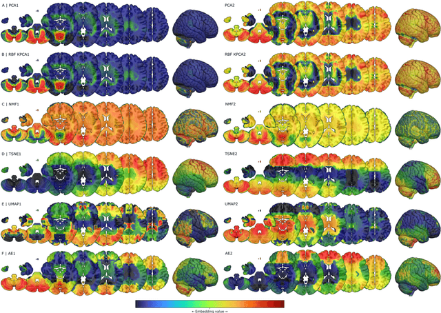 Figure 2 for Compressed representation of brain genetic transcription