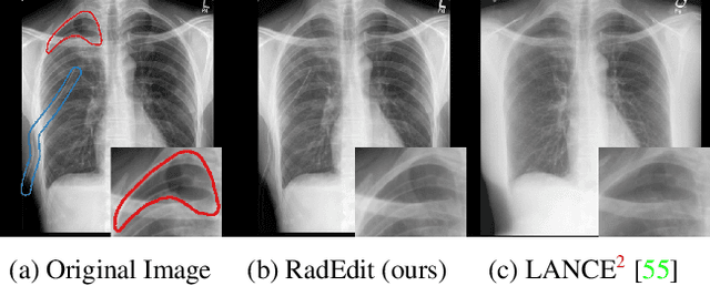 Figure 3 for RadEdit: stress-testing biomedical vision models via diffusion image editing