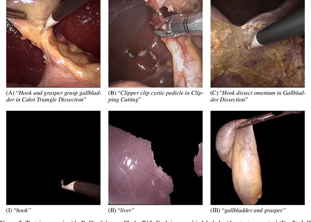 Figure 3 for Navigating the Synthetic Realm: Harnessing Diffusion-based Models for Laparoscopic Text-to-Image Generation