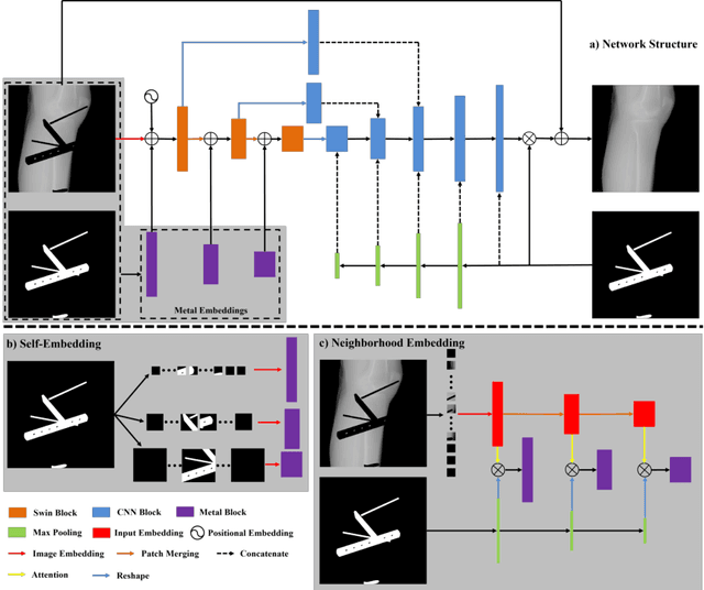 Figure 1 for Metal-conscious Embedding for CBCT Projection Inpainting