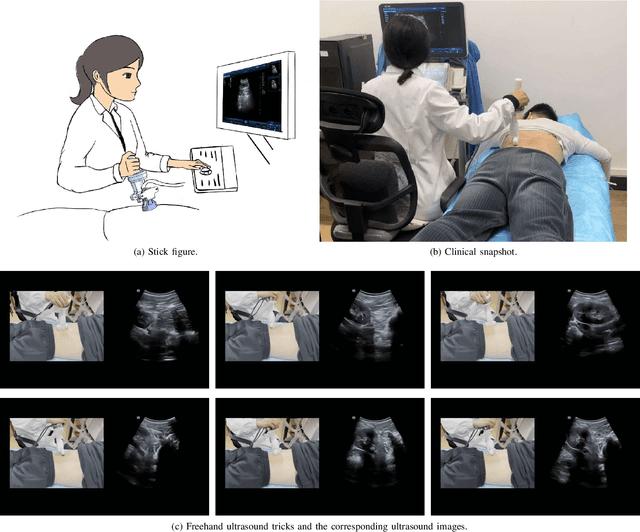 Figure 4 for Learning Autonomous Ultrasound via Latent Task Representation and Robotic Skills Adaptation