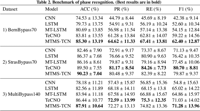 Figure 4 for Challenges in Multi-centric Generalization: Phase and Step Recognition in Roux-en-Y Gastric Bypass Surgery