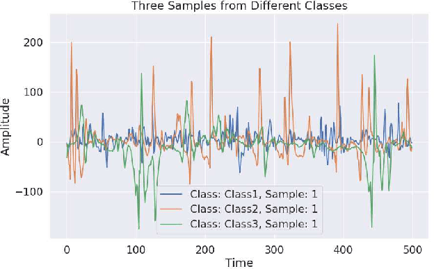 Figure 1 for EMG Signal Classification for Neuromuscular Disorders with Attention-Enhanced CNN