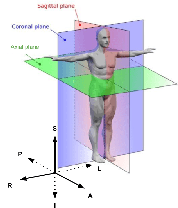 Figure 4 for Self-Supervised Pretext Tasks for Alzheimer's Disease Classification using 3D Convolutional Neural Networks on Large-Scale Synthetic Neuroimaging Dataset