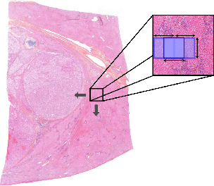 Figure 2 for A transductive few-shot learning approach for classification of digital histopathological slides from liver cancer