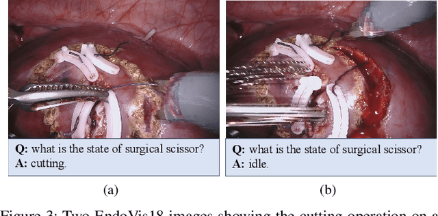 Figure 3 for LLM-Assisted Multi-Teacher Continual Learning for Visual Question Answering in Robotic Surgery