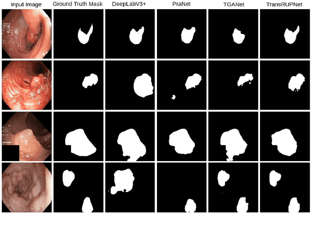 Figure 3 for TransRUPNet for Improved Out-of-Distribution Generalization in Polyp Segmentation