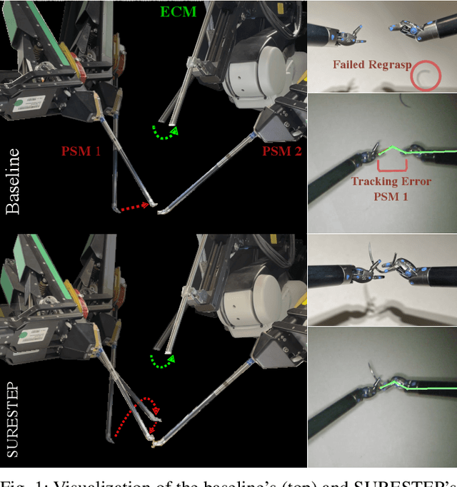 Figure 1 for SURESTEP: An Uncertainty-Aware Trajectory Optimization Framework to Enhance Visual Tool Tracking for Robust Surgical Automation