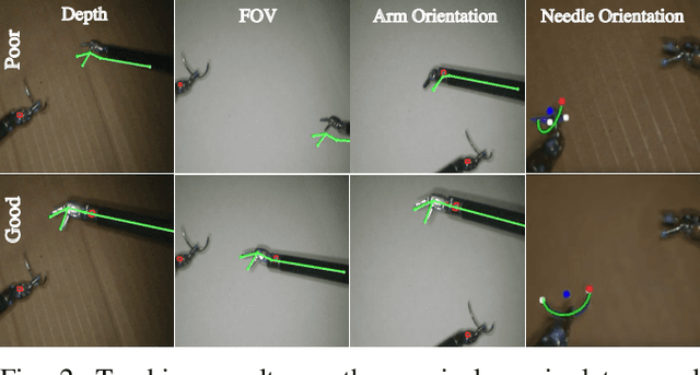 Figure 2 for SURESTEP: An Uncertainty-Aware Trajectory Optimization Framework to Enhance Visual Tool Tracking for Robust Surgical Automation