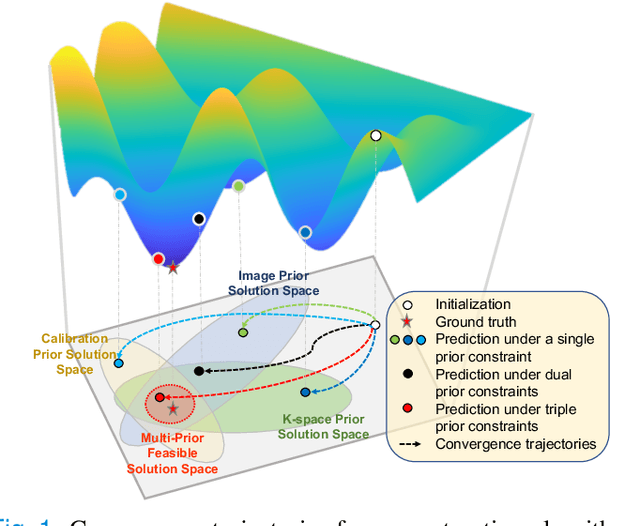 Figure 1 for CAMP-Net: Context-Aware Multi-Prior Network for Accelerated MRI Reconstruction