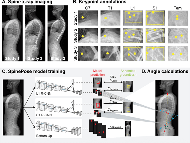 Figure 1 for Development and validation of an artificial intelligence model to accurately predict spinopelvic parameters