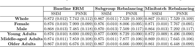 Figure 2 for Unveiling Fairness Biases in Deep Learning-Based Brain MRI Reconstruction