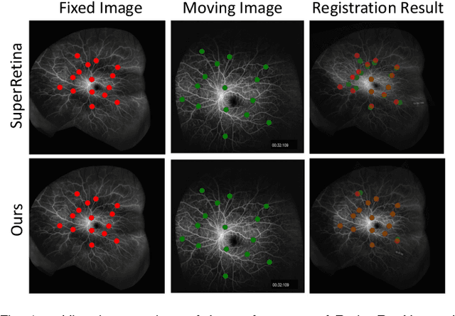 Figure 1 for RetinaRegNet: A Versatile Approach for Retinal Image Registration