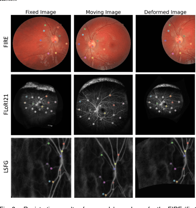 Figure 3 for RetinaRegNet: A Versatile Approach for Retinal Image Registration