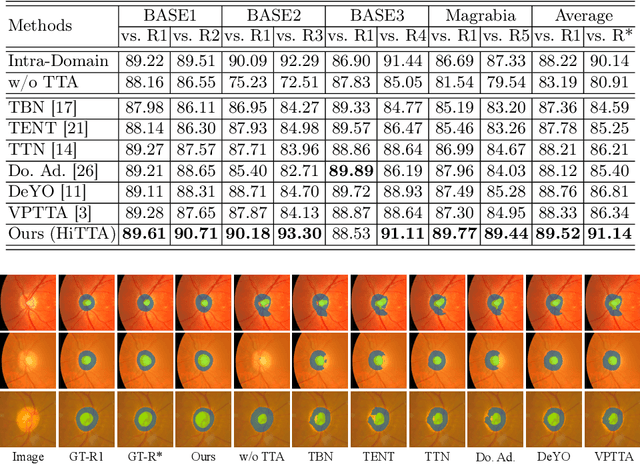 Figure 4 for Towards Clinician-Preferred Segmentation: Leveraging Human-in-the-Loop for Test Time Adaptation in Medical Image Segmentation