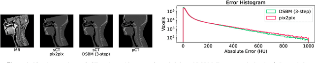 Figure 1 for Diffusion Schrödinger Bridge Models for High-Quality MR-to-CT Synthesis for Head and Neck Proton Treatment Planning