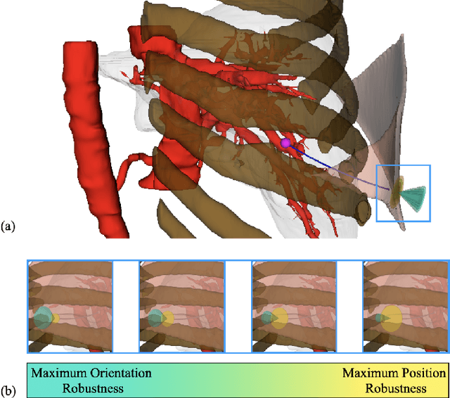 Figure 1 for Safe Start Regions for Medical Steerable Needle Automation