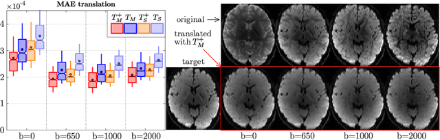 Figure 2 for Eddeep: Fast eddy-current distortion correction for diffusion MRI with deep learning