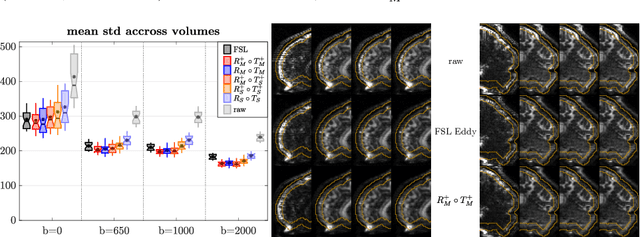 Figure 3 for Eddeep: Fast eddy-current distortion correction for diffusion MRI with deep learning