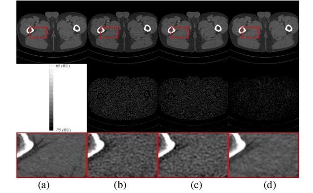 Figure 2 for Partitioned Hankel-based Diffusion Models for Few-shot Low-dose CT Reconstruction