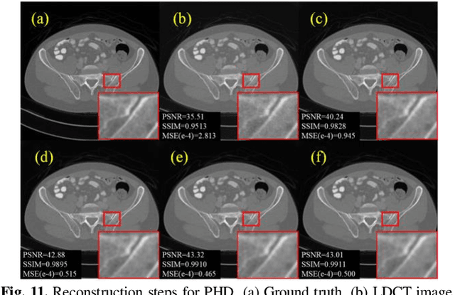 Figure 3 for Partitioned Hankel-based Diffusion Models for Few-shot Low-dose CT Reconstruction