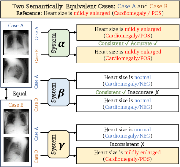 Figure 1 for ICON: Improving Inter-Report Consistency of Radiology Report Generation via Lesion-aware Mix-up Augmentation