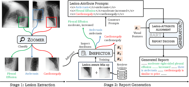 Figure 3 for ICON: Improving Inter-Report Consistency of Radiology Report Generation via Lesion-aware Mix-up Augmentation