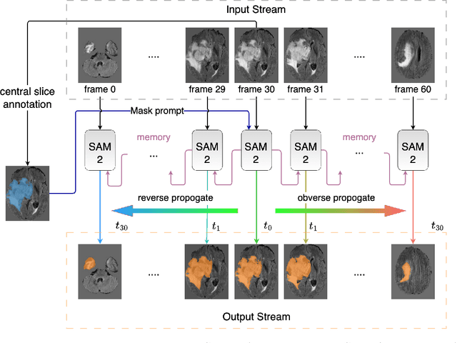 Figure 1 for Interactive 3D Medical Image Segmentation with SAM 2