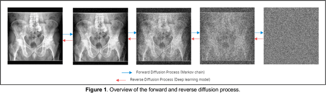 Figure 1 for RadRotator: 3D Rotation of Radiographs with Diffusion Models
