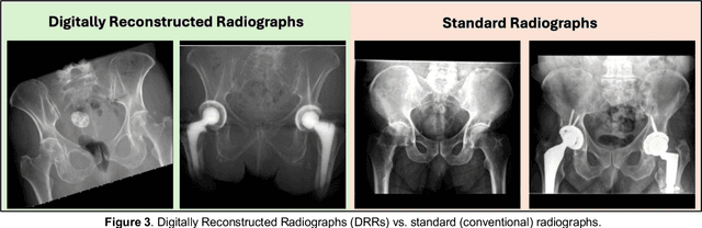 Figure 3 for RadRotator: 3D Rotation of Radiographs with Diffusion Models