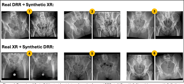 Figure 4 for RadRotator: 3D Rotation of Radiographs with Diffusion Models